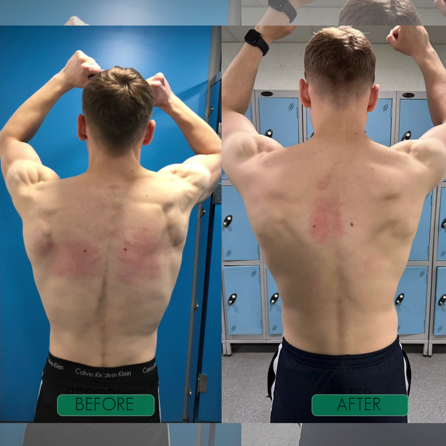 Posture Perfection Brace