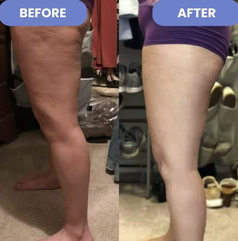 Sculptiva Glow Cellulite Massager