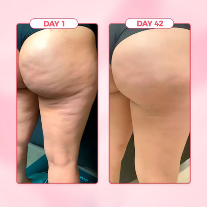 Sculptiva Glow Cellulite Massager