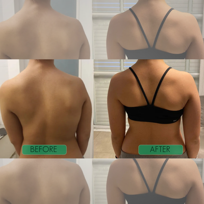 Posture Perfection Brace
