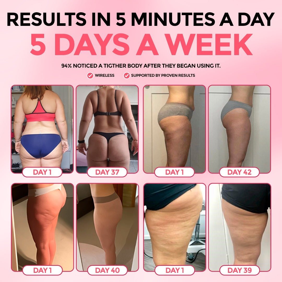 Sculptiva Glow Cellulite Massager