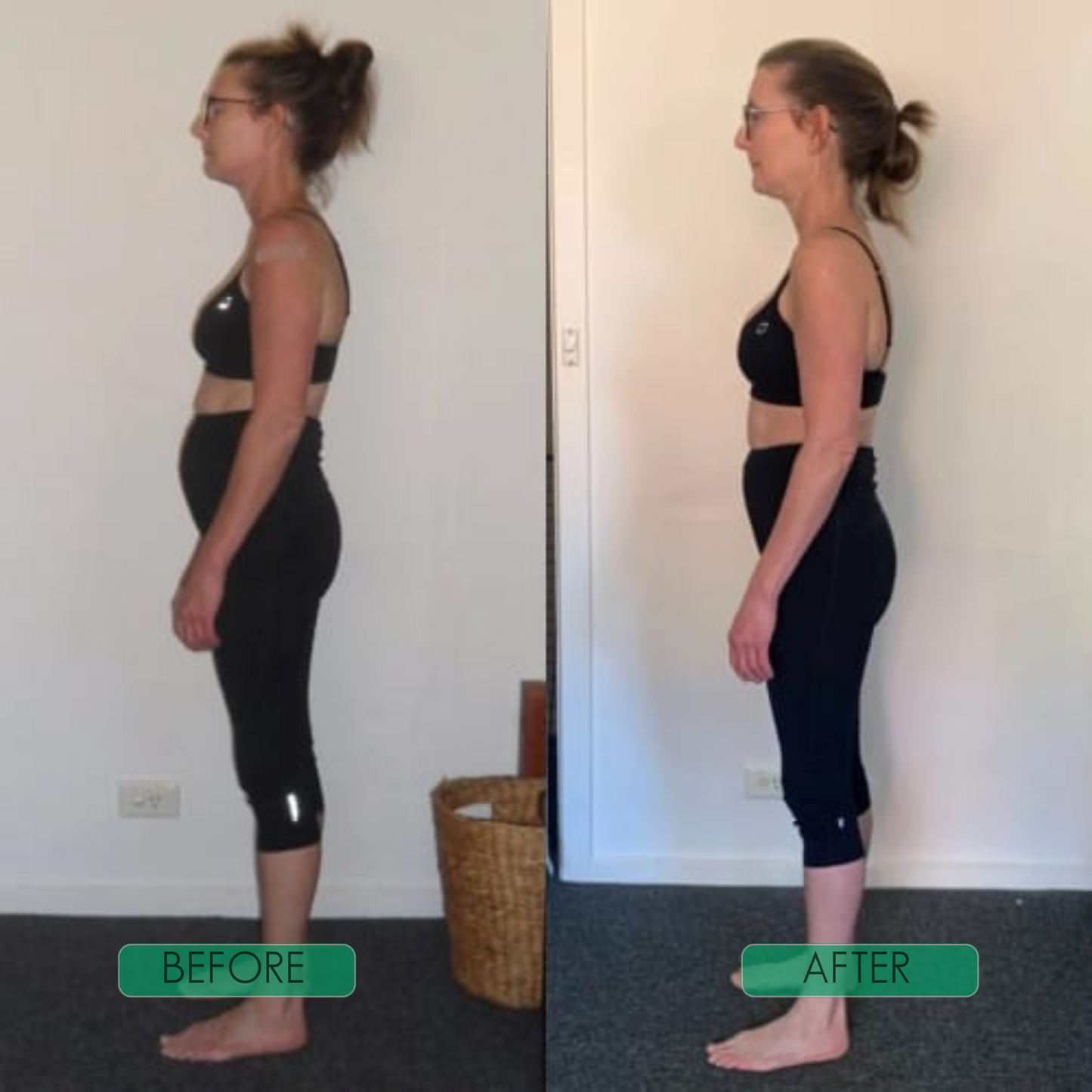Posture Perfection Brace