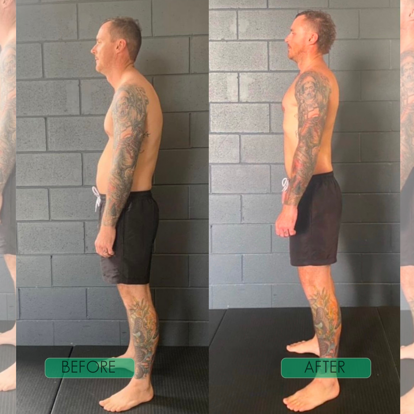 Posture Perfection Brace